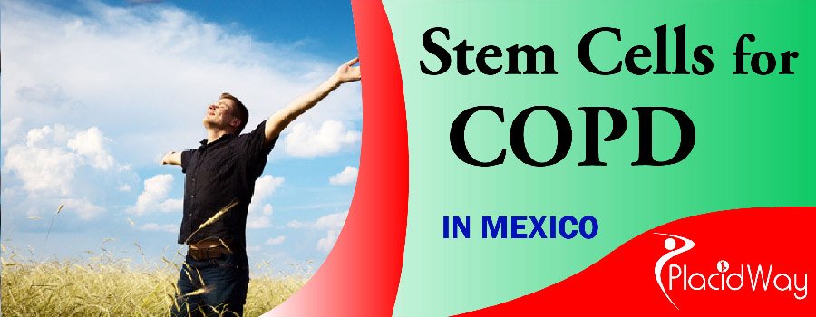 Stem Cell Treatment for COPD in Mexico